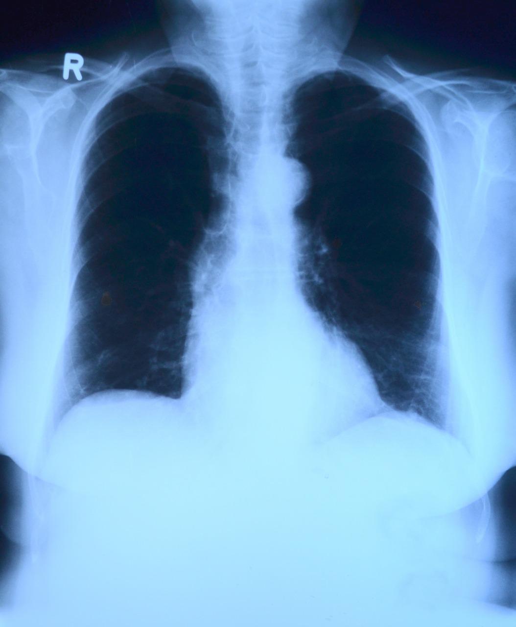 radiografia a casa.jpg