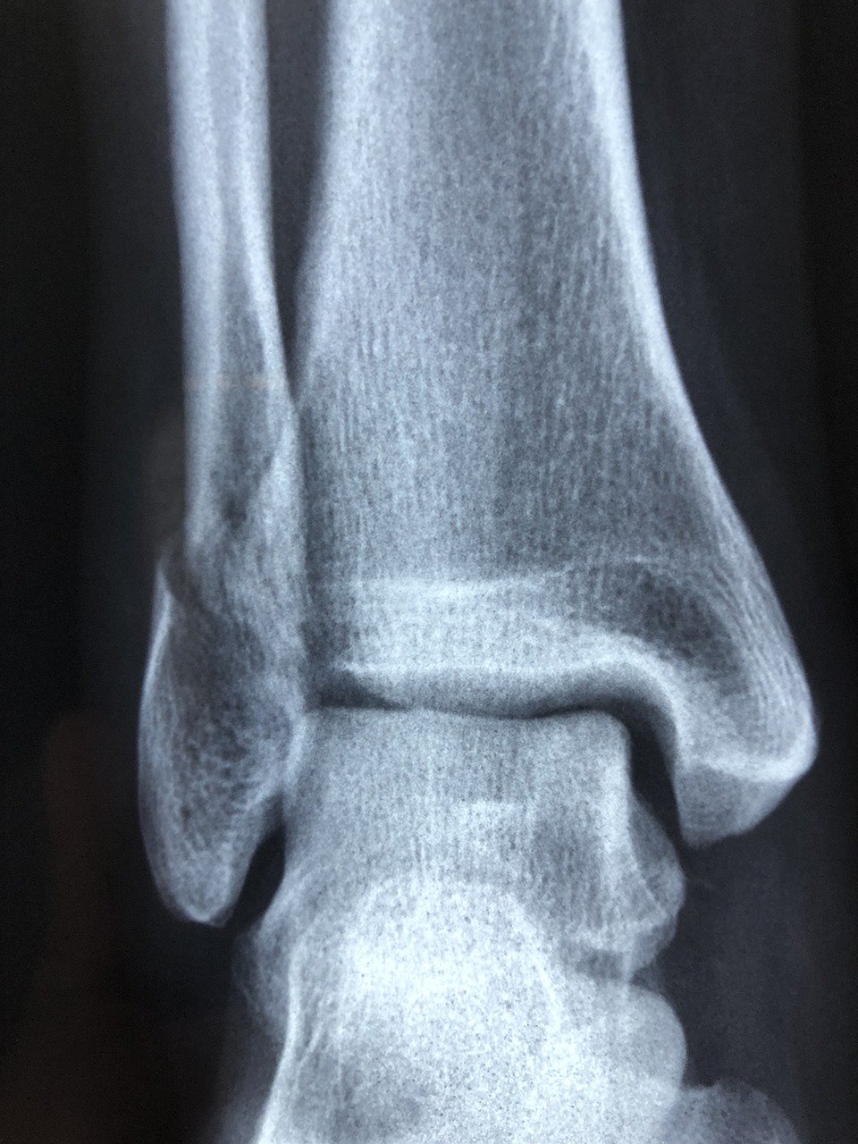 radiografia%20in%20casa.jpg
